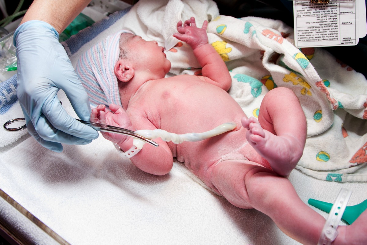 What Will You Do With Baby's Umbilical Cord After Birth?
